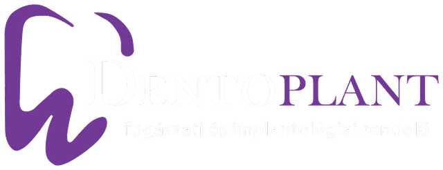 Dentoplant