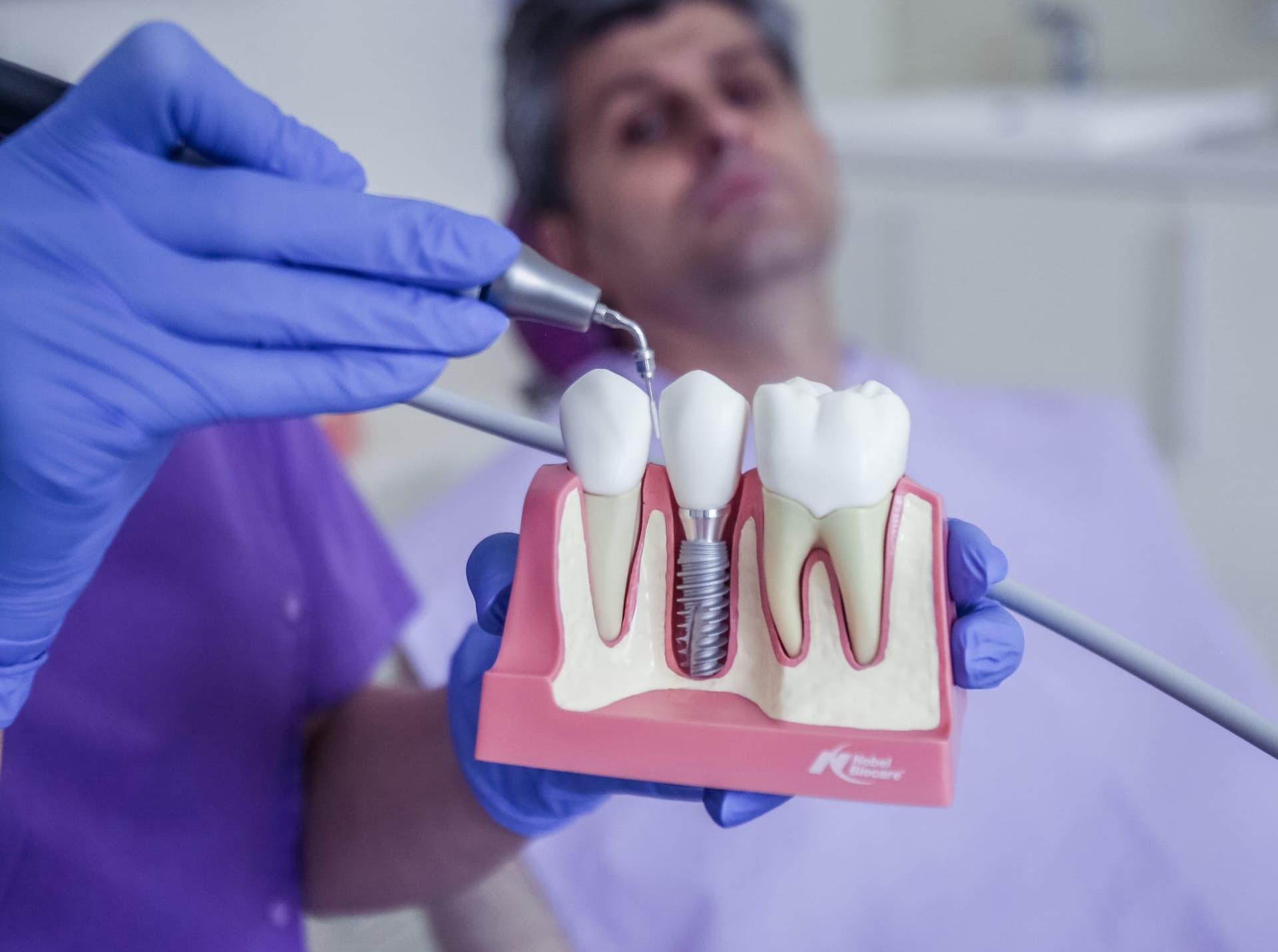 Implantátum higiéniai kezelés a Dentoplant rendelőben (4)